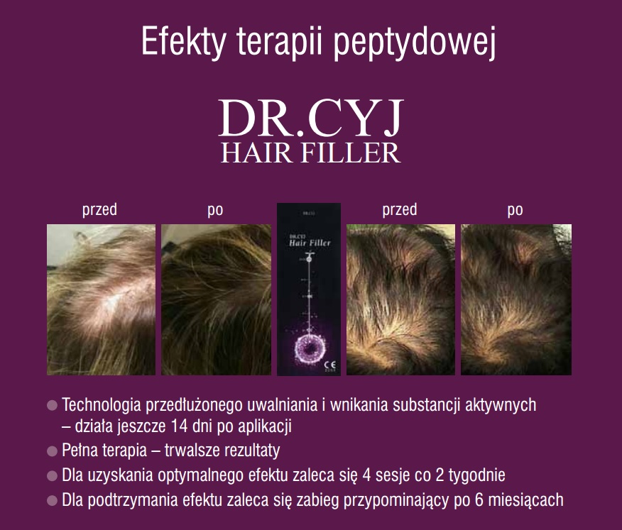 peptydowa terapia włosów